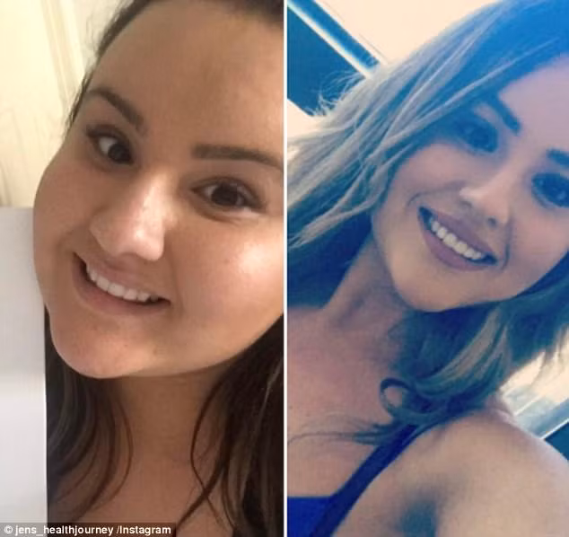 Sau đó chế độ ăn uống của cô thay đổi hoàn toàn, cô bỏ luôn tinh bột vì không ăn nổi. Năm tháng rưỡi sau phẫu thuật, Jennifer đã giảm được 57kg , cô nhận thấy mình đã khác trước rất nhiều. Trước khi đi du lịch, cô thường nằm lì một chỗ thì giờ đây, cô cảm thấy mình tràn đầy năng lượng cho những hoạt động leo núi, ngắm cảnh, không còn sợ nắng nóng.