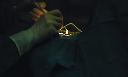 Một bệnh nhân là công nhân xây dựng tên Li Ping bị mù mắt trái sau khi bị viêm mắt nên khó có thể gánh vác kinh tế cho gia đình. Bệnh nhân này đã bỏ ra số tiền khoảng 150 triệu để ghép giác mạc nhưng chỉ sau khi phẫu thuật mới biết đó là giác mạc lợn. Lúc này, anh Li Ping cho biết “Tôi không biết nên cảm thấy như thế nào nhưng đối với người không có khả năng nhìn được thì việc lại có thể nhìn được bình thường, dù là với giác mạc lợn, vẫn tốt hơn rất nhiều”. (Nguồn ảnh: CBS)