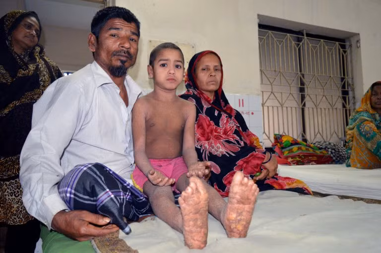 Mehdi Hassan mắc một bệnh ngoài da hiếm gặp khiến người cậu bé bị bao bọc bởi những lớp da cứng ngứa ngáy. Điều này khiến Mehdi gặp khó khăn trong đi lại hay chạm tay vào bất cứ vật gì và cậu dần dần bị mọi người xung quanh xa lánh.