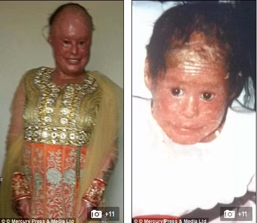 Nhưng vì bố mẹ của cô đã mất đi 3 người con bị bệnh tương tự nên họ rất mong bệnh viện làm gì đó để có thể cứu con gái mình. 