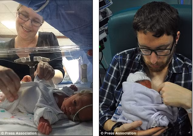 Hai bé này bị mắc hội chứng truyền máu song thai, tức giữa hai bé xảy ra sự truyền máu bất thường khiến bé Jake nhận được tất cả các dưỡng chất, còn Oli thì luôn đói vì không đủ chất. Hội chứng này xảy ra với khoảng 15-20% ca sinh đôi cùng trứng. 