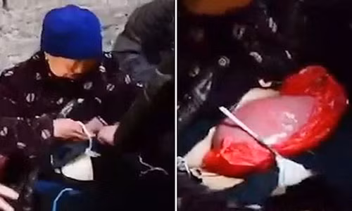 Hiện bác sĩ địa phương đã đến thăm và đưa cho cụ một ít thuốc giảm đau. Hy vọng thời gian tới trường hợp của cụ Lan sẽ được nhiều người biết đến và giúp đỡ.