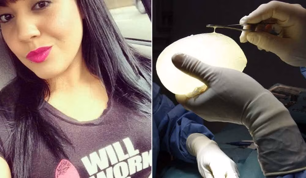 Beverly Brignoni tìm đến một cơ sở nhỏ tại Dominica để cắt da thừa ở bụng, nâng mông và nâng ngực và tin rằng mình sẽ được an toàn. Tuy nhiên chưa đầy 24 sau khi tới đây thì cô qua đời trong khi bạn trai vẫn đang chờ ở ngoài. Bác sĩ cho biết cô bị tắc mạch phổi. Sau cái chết của cô Beverly thì bệnh viên mau chóng bị đóng cửa vì bị phát hiện vi phạm các điều kiện vệ sinh. 