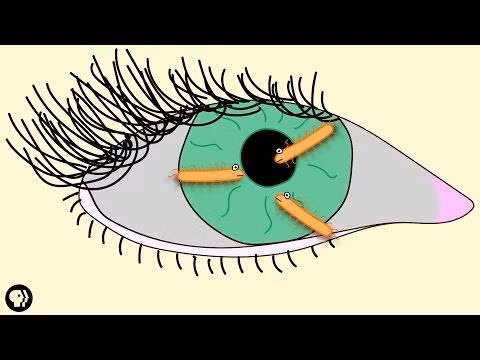 Một nghiên cứu gần đây tại Australia lại cho thấy trong khoảng thời gian đeo kính áp tròng là 10 năm thì tỉ lệ nhiễm trùng mắt, thậm chí ảnh hưởng đến thị lực là 1/200 lần; còn nếu phẫu thuật LASIK thì nguy cơ nhiễm trùng thấp hơn 15 lần với tỉ lệ 1/3.000.