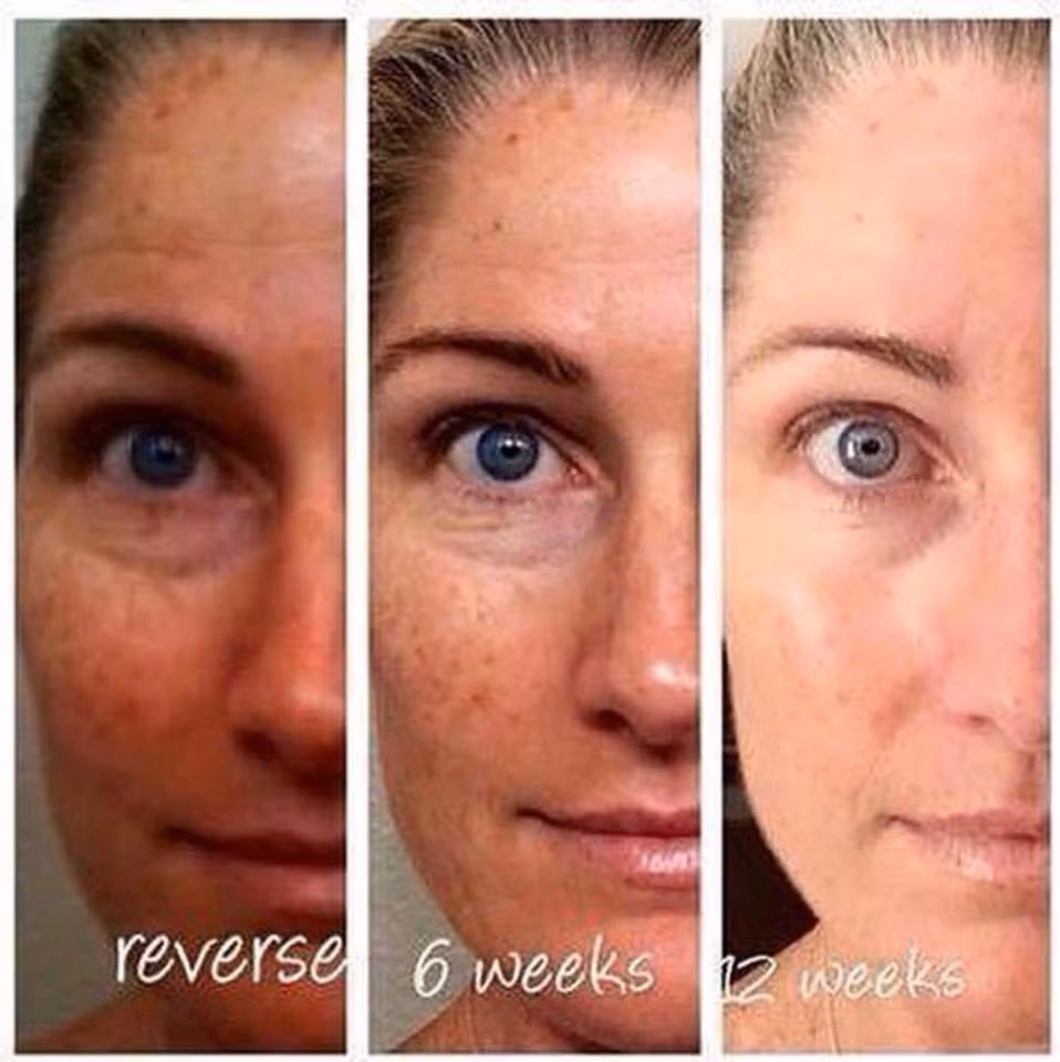 Da cũng là một tổ chức nên nó phản ứng với cả các vấn đề bên trong và bên ngoài, thể hiện rất nhiều về hiện trạng sức khỏe. Cách nhận biết làn da đơn giản nhất là qua màu sắc. Chẳng hạn như da vàng có thể là do có vấn đề ở túi mật, da xanh do ăn phải một số chất, da nâu là do thận không tốt…Ngoài ra các tác động từ bên ngoài cũng có thể làm da bị biến màu, để lại đốm nâu, tăng mạch máu và làm da bị đỏ. Làn da lý tưởng phải là một làn da đều màu và không thay đổi theo thời gian. (Ảnh: Pinterest) 