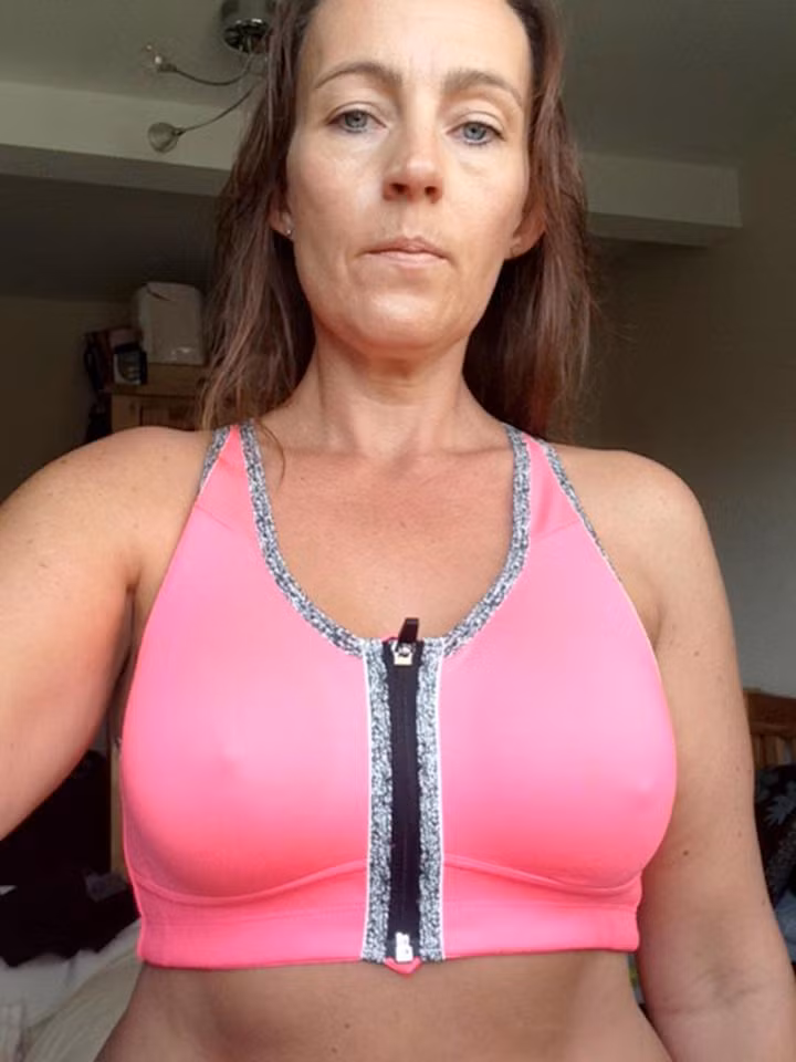 Sau khi tự mình nghiên cứu và phát hiện nguyên nhân chính xác, cô mới tìm đến một bác sĩ có tiếng tại Hà Lan để tháo khối silicon ra ngoài một cách an toàn nhất với giá thành không hề rẻ. 