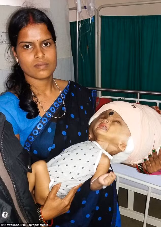 Bệnh não úng thủy cũng có thể là một dị tật bẩm sinh do nứt đốt sống hoặc do khi mang thai, người mẹ bị cúm hoặc rubella. Nếu không điều trị thì bệnh gây ảnh hưởng đến não vĩnh viễn khiến bệnh nhân có thể bị tàn tật cả về thể chất và tinh thần. 