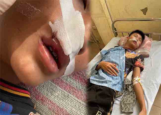 Nam sinh bi ban hoc cung truong danh nhap vien o Ha Noi