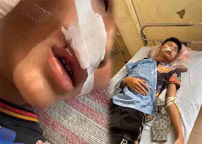 Nam sinh bi ban hoc cung truong danh nhap vien o Ha Noi