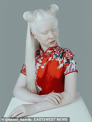 Aiman Sarkitova (38 tuổi), mẹ của Asel và Kamila chia sẻ rằng lúc mới sinh Asel, chị và mọi người trong gia đình đều vô cùng sốc vì cô bé khác biệt so với các thành viên còn lại trong nhà.