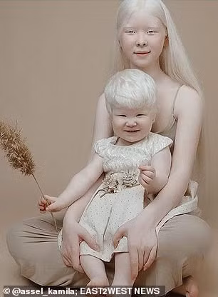 Theo đó, hai chị em Asel (14 tuổi) và Kamila (2 tuổi) bị chứng bạch tạng từ khi sinh ra.