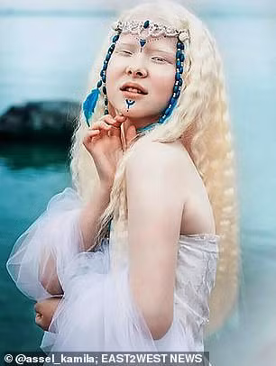 Do đó, Asel gặp nhiều khó khăn khi đi học, bởi diện mạo lạ lẫm của cô bé từng khiến các bạn học khác xì xào, bàn tán.