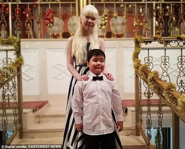 Được biết, ngoài Kamila, Asel còn có một em trai tên Aldiyar (8 tuổi), tuy nhiên diện mạo cậu bé hoàn toàn bình thường và rất giống bố mẹ.