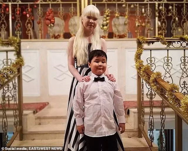 Được biết, ngoài Kamila, Asel còn có một em trai tên Aldiyar (8 tuổi), tuy nhiên diện mạo cậu bé hoàn toàn bình thường và rất giống bố mẹ.