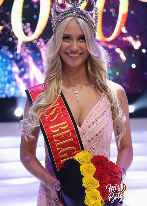 Sau khi giành vương miện, Celine chia sẻ, cô tin rằng cú ngã của cô sẽ truyền cảm hứng đến mọi người.