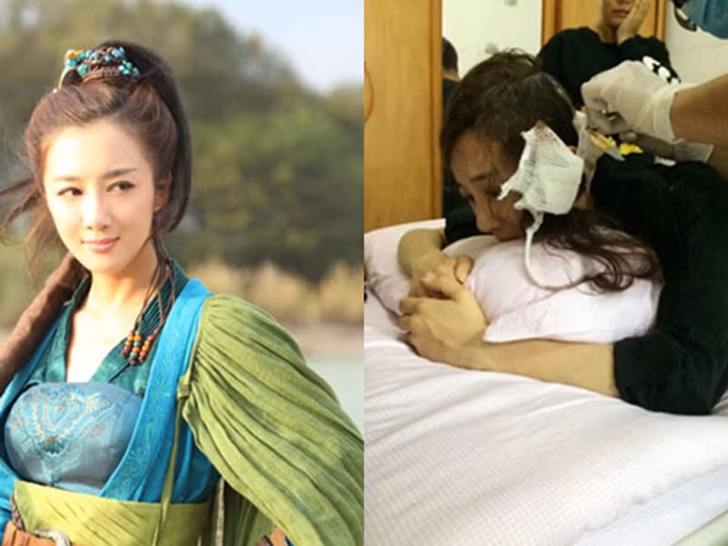 Năm 2014, Diệp Tuyền mang theo vài chú chó đến phim trường, trong đó có một chú chó Alaska đã tấn công Lý Y Hiểu khiến cô phải khâu đến 20 mũi ở gáy và tai.