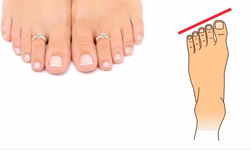 Tuong ban chan xau dau don nhung lai cuc ky hut loc