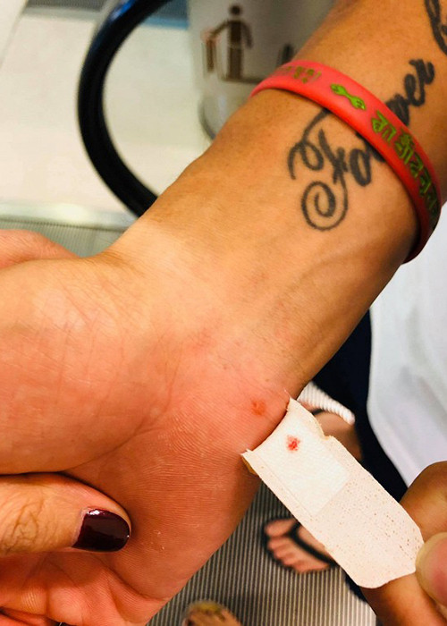 Người hâm mộ "cười bò" khi Công Vinh khiến Thủy Tiên tức vì làm lố vết thương nhỏ thành "vết bị đâm tí chết".