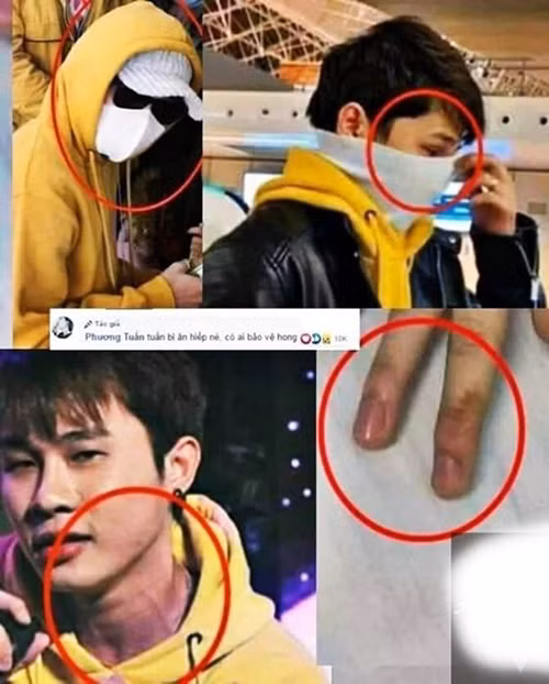 Ro nghi van Jack bi hanh hung, K-ICM nhan tin de doa