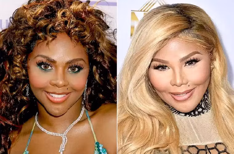 Ngam ve dep tu nhien truoc phau thuat tham my cua sao-Hinh-7