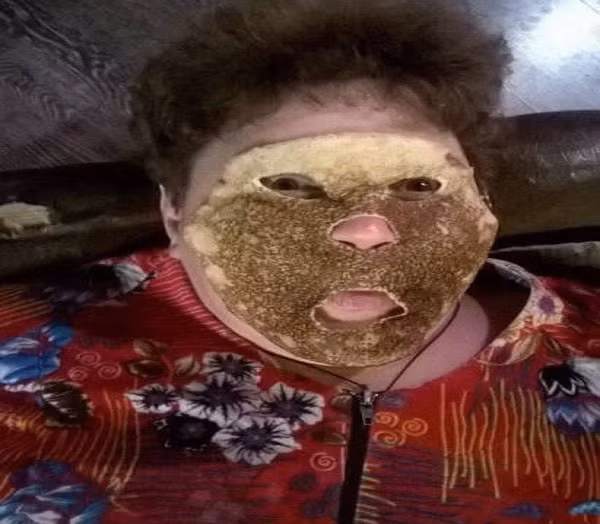 Chắc hẳn không ít người giật mình khi nhìn thấy khuôn mặt này. Ảnh: ER.