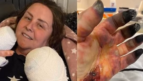 Nhiễm bệnh lạ, người phụ nữ có bàn tay phù thủy đáng sợ Nhiem benh la, nguoi phu nu co ban tay phu thuy dang so