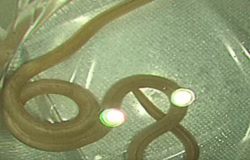 Dau bung du doi, di kham phat hien “quai thu” ky sinh