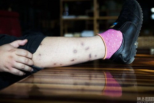 Tuy vậy, sinh nghề từ nghiệp, không gì có thể lay chuyển sự đam mê bất tận của Gia Thạch đối với những độc thú này.