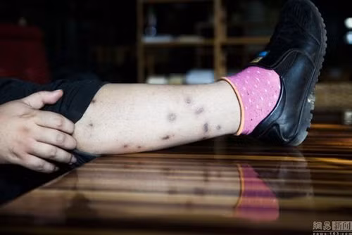 Tuy vậy, sinh nghề từ nghiệp, không gì có thể lay chuyển sự đam mê bất tận của Gia Thạch đối với những độc thú này.