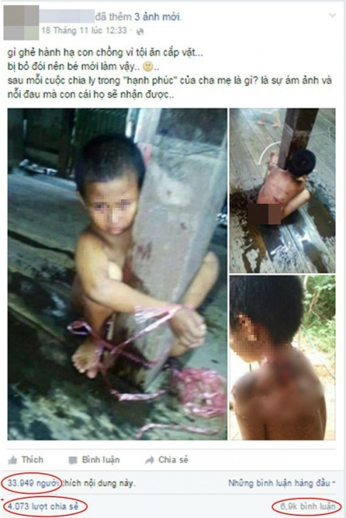 Cư dân mạng phẫn nộ vì bức ảnh kèm theo câu chuyện cậu bé bị dì ghẻ hành hạ, tra tấn.