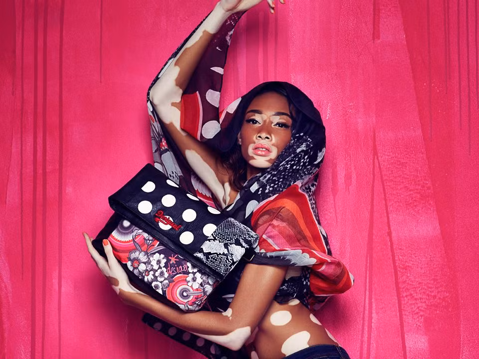 Có thể nói Chantelle Brown-Young là người mẫu bạch biến không hoàn toàn đầu tiên của làng thời trang thế giới. Cô đã phá vỡ mọi nguyên tắc về sự hoàn hảo, về chuẩn mực cái đẹp.