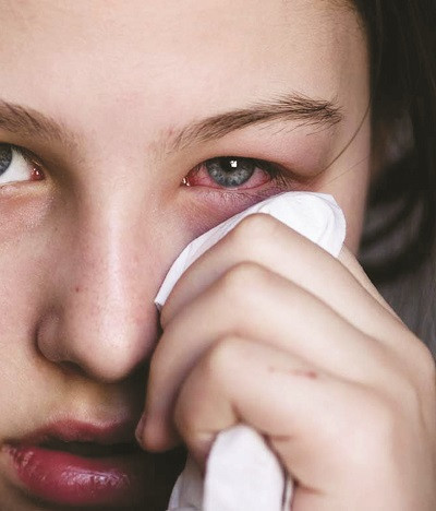 Chữa viêm kết mạc: Nước lá táo được dùng để rửa mắt trong trường hợp viêm kết mạc cũng tốt.