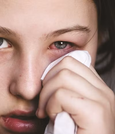 Chữa viêm kết mạc: Nước lá táo được dùng để rửa mắt trong trường hợp viêm kết mạc cũng tốt.