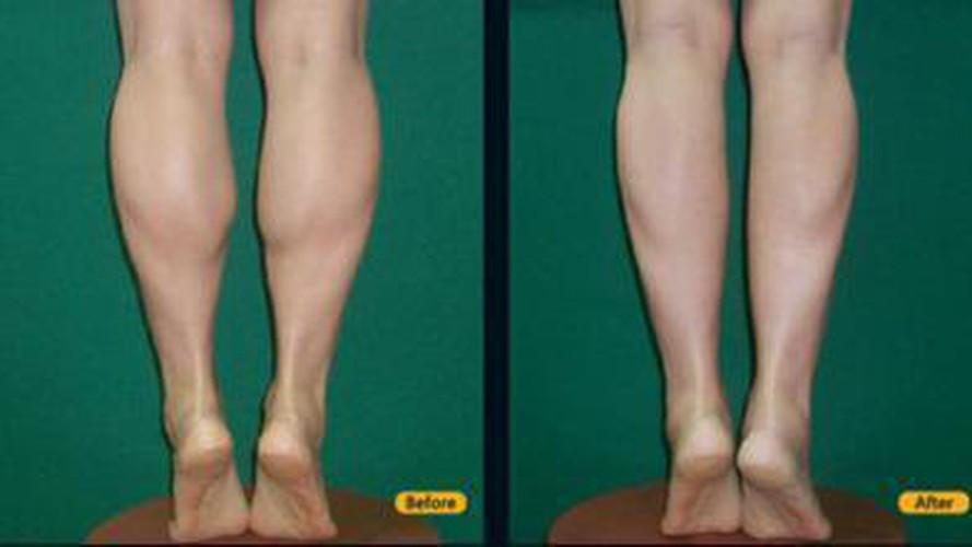 Hãy bắt đầu bằng việc đứng thẳng người, rồi từ từ kiễng chân lên. Động tác này giúp chân bạn cũng thon thả hơn.