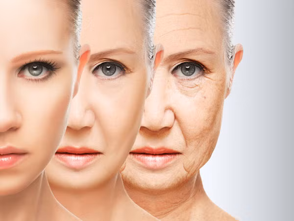 Lão hóa là một trong những lý do phổ biến nhất khiến lỗ chân lông to.