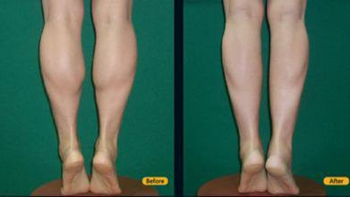 1. Thúc đẩy lưu thông máu đến chi dưới Hiện nay nhiều người ít tập thể dục, ngồi lâu trong văn phòng trong một thời gian dài, ngăn chặn sự lưu thông máu của các chi dưới, dễ gây tê chân, đồng thời tăng nguy cơ bị giãn tĩnh mạch chi dưới.