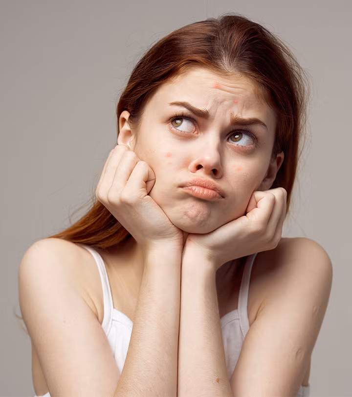 Trang điểm thường xuyên cũng là một nguyên nhân khiến bạn bị nổi mụn chi chít trên trán. Ảnh: stylecraze.