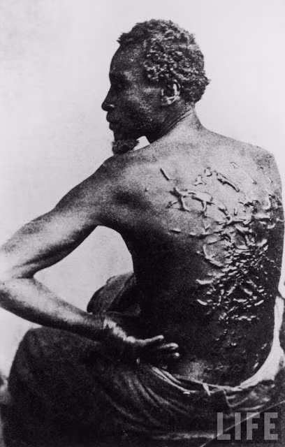 Hình ảnh ám ảnh chụp Gordon - một nô lệ ở Baton Rouge, Louisiana, Mỹ với đầy vết sẹo ở lưng do chủ nô đánh đập. Ảnh chụp năm 1863.