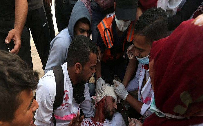Một người biểu tình Palestine bị thương trong cuộc đụng độ với lực lượng Israel. Ảnh: Reuters.