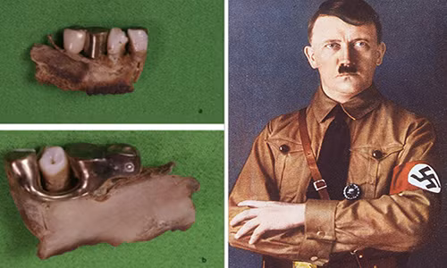 Những mảnh răng và hộp sọ được cho là thuộc về Adolf Hitler.