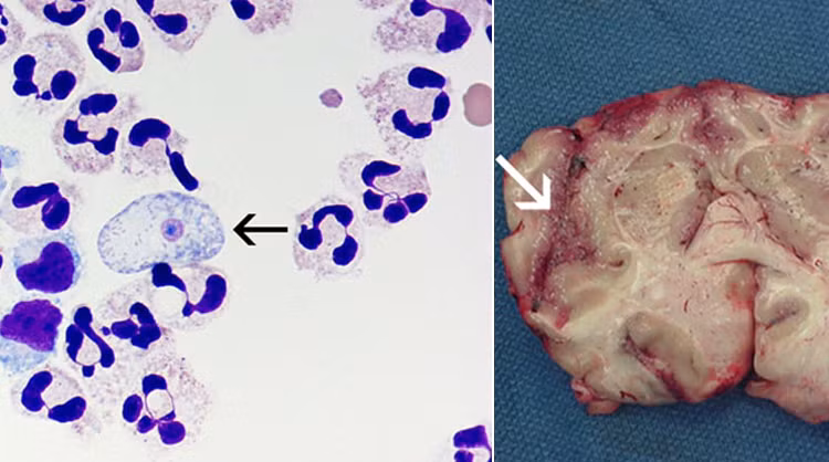 Nhung loai ky sinh trung ky la nhat: Nguon cam hung cua cac Alien-Hinh-5