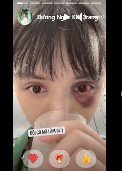 Đến nay, Khả Trang chưa lên tiếng về danh tính người bạo hành.