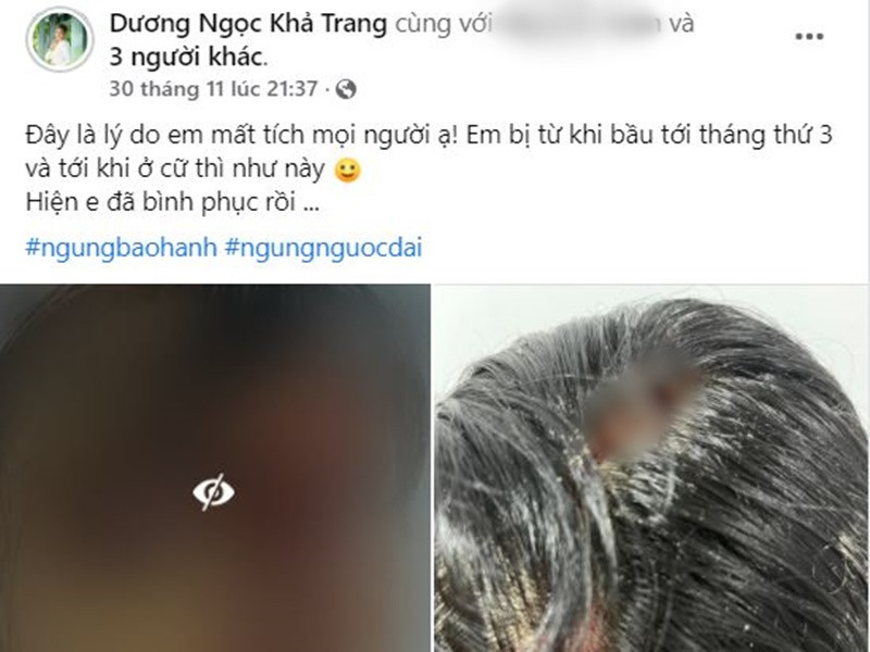 Tối ngày 30/11, siêu mẫu Khả Trang bất ngờ tung loạt ảnh bị bạo hành. Sau đó, cô giữ im lặng. Cho đến tối ngày 2/12, nữ người mẫu chia sẻ thêm thông tin sự việc.