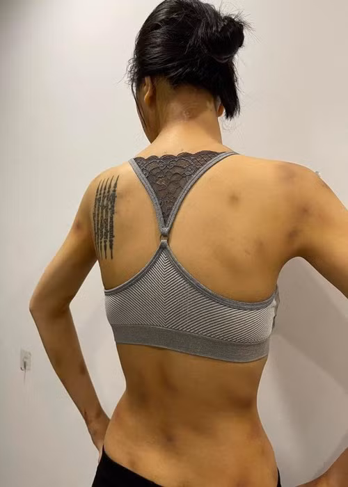 Khả Trang lộ thương tích khắp người. Ảnh: Vietnamnet