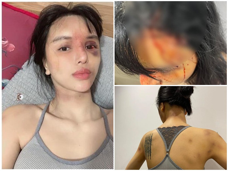  Siêu mẫu Khả Trang trở thành tâm điểm của dư luận sau khi tung loạt ảnh tố bị bạo hành, phải nhập viện. Nữ người mẫu cho biết: “Đây là lý do tôi mất tích mọi người ạ. Tôi bị từ khi bầu tới tháng thứ 3 và tới khi ở cữ thì như này”. Ngoài ra, bài viết của Khả Trang còn gắn hashtag ngừng ngược đãi, ngừng bạo hành. Tuy nhiên, hiện tại, chia sẻ của nữ người mẫu không còn trên trang cá nhân.