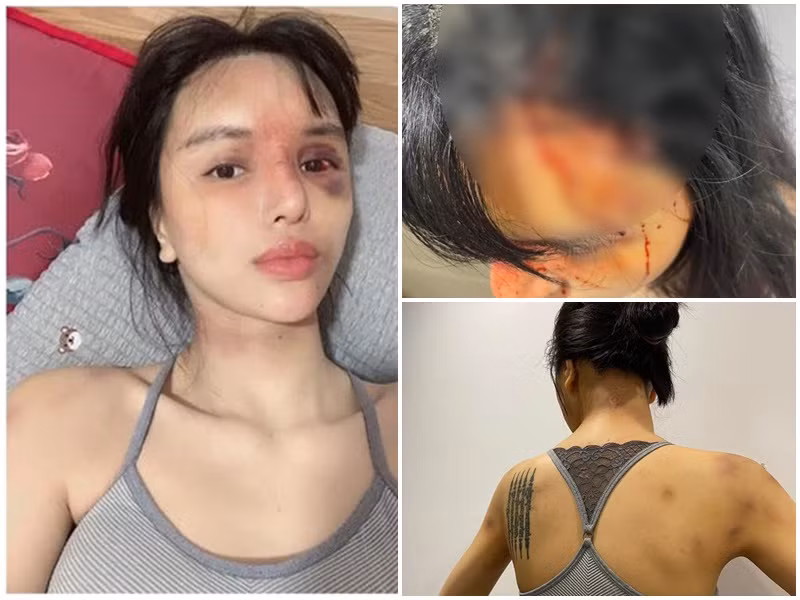  Siêu mẫu Khả Trang trở thành tâm điểm của dư luận sau khi tung loạt ảnh tố bị bạo hành, phải nhập viện. Nữ người mẫu cho biết: “Đây là lý do tôi mất tích mọi người ạ. Tôi bị từ khi bầu tới tháng thứ 3 và tới khi ở cữ thì như này”. Ngoài ra, bài viết của Khả Trang còn gắn hashtag ngừng ngược đãi, ngừng bạo hành. Tuy nhiên, hiện tại, chia sẻ của nữ người mẫu không còn trên trang cá nhân.