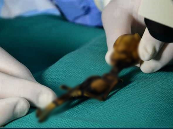 Trong nhiều năm, người dân đồn đoán bộ xương Ata là thi thể người ngoài hành tinh gặp sự cố khi ghé thăm Trái đất. Thế nhưng, về sau, nghiên cứu của các chuyên gia chỉ ra Ata là bộ xương của một bé gái sống ở Chile sau những năm 1500. Kết quả kiểm tra ADN của bé gái này có những đột biến gen khiến cơ thể có những đặc điểm bất thường.