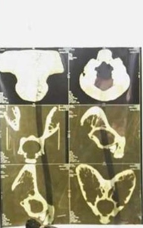 Người Anunnaki được người xưa coi là các vị thần. Chính vì vậy, họ có những đặc điểm cơ thể khác với con người.