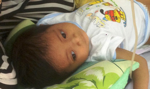 Bí ản nguoi lun dau chim ỏ Bẹnh viẹn Nhi Dòng 1