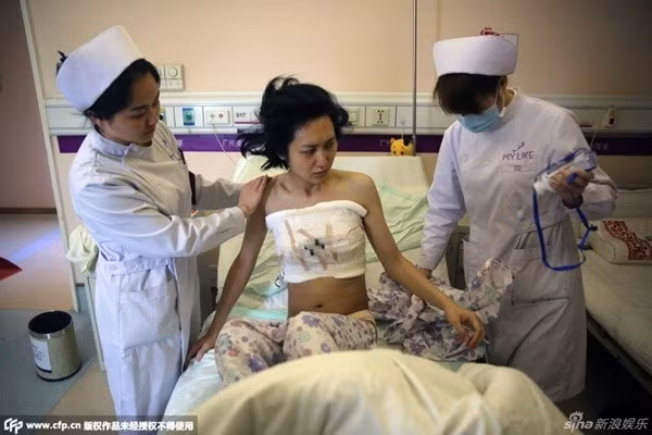 Hình ảnh sau ca mổ.